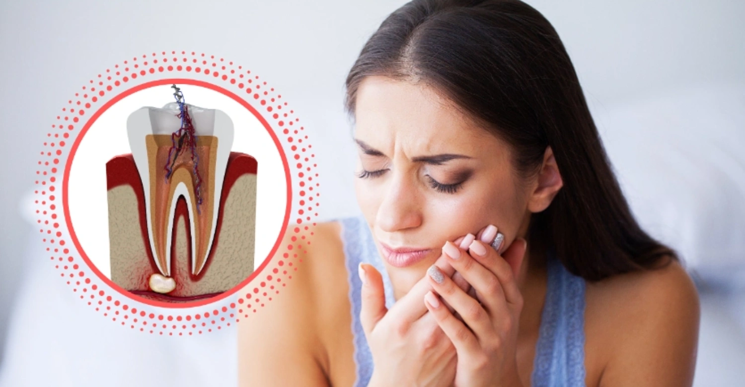 How Long Is the Root Canal Recovery Inblog